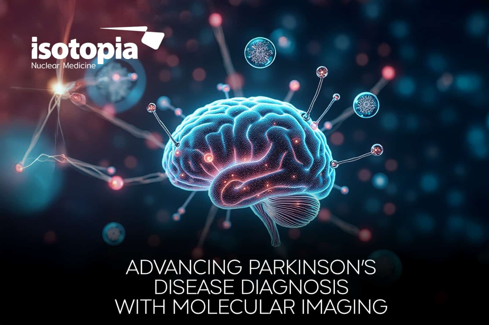 Marking International Parkinson's Disease Day:  The Power of [18F]-FDOPA PET/CT in Diagnosis