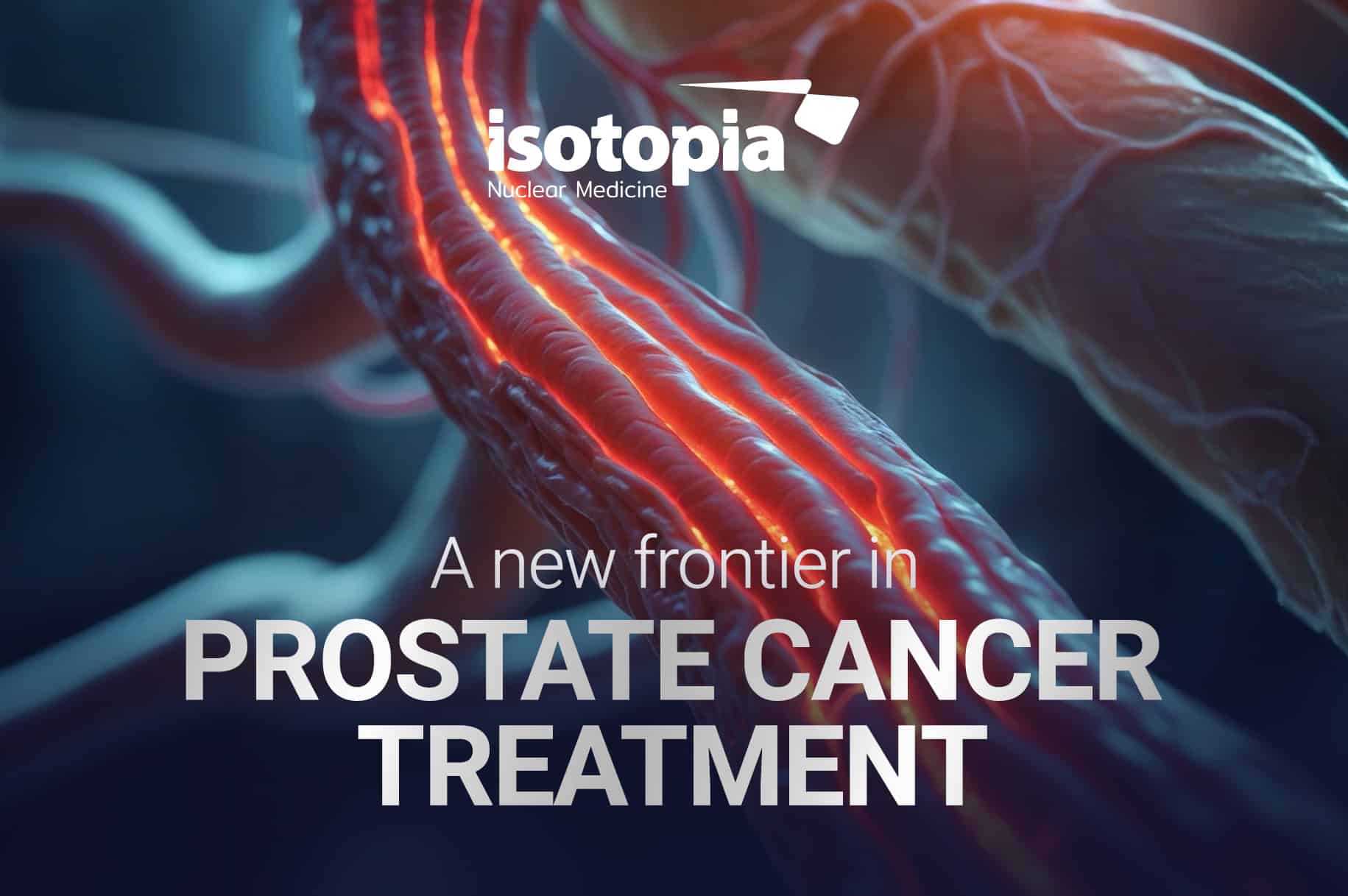 Intra-arterial Radiotherapy for Prostate Cancer—Revolutionary or Reckless?