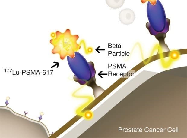 Vision study - Research on Prostate Cancer