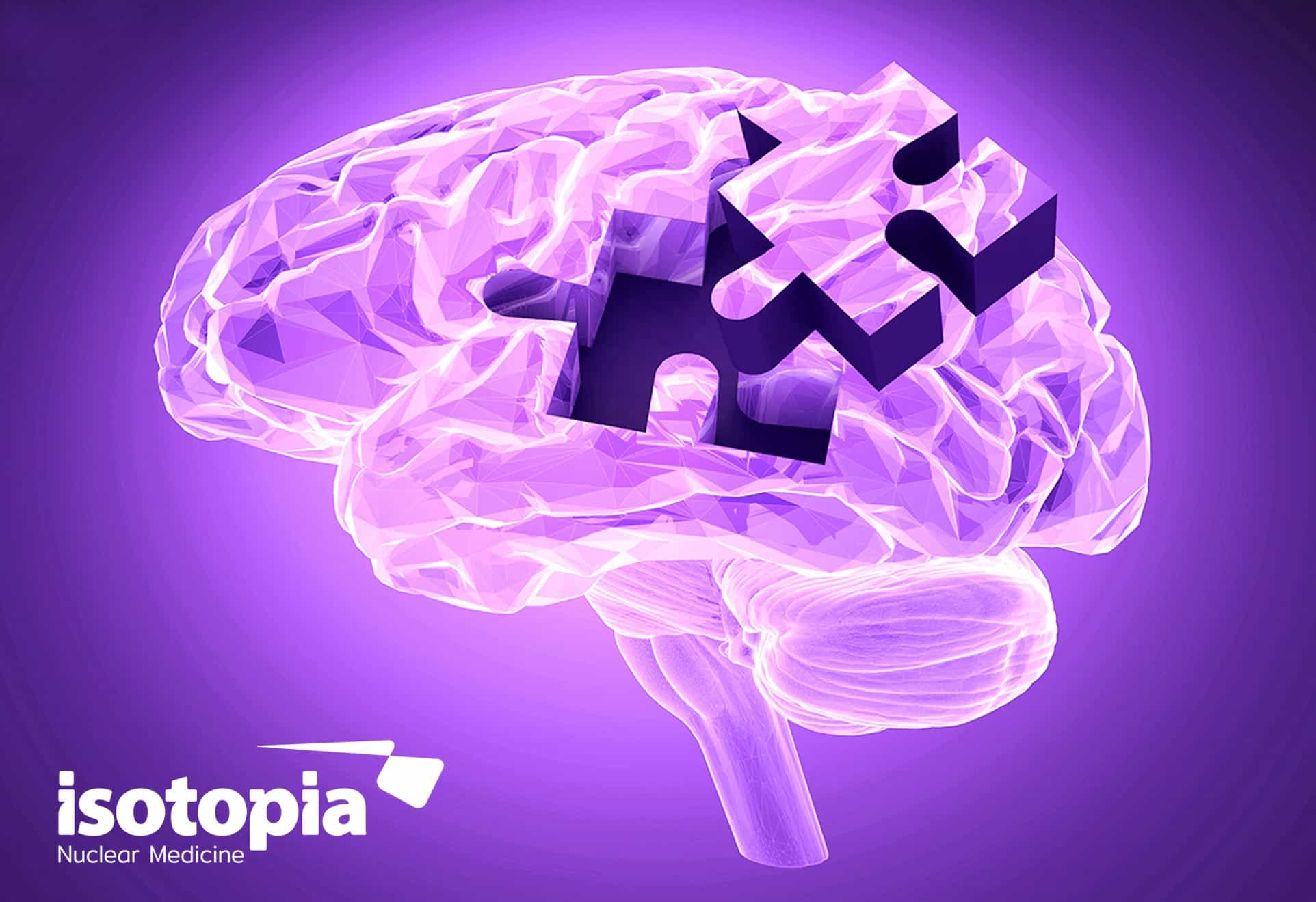 Nuclear imaging in Parkinson's disease- The past, the present, and the future