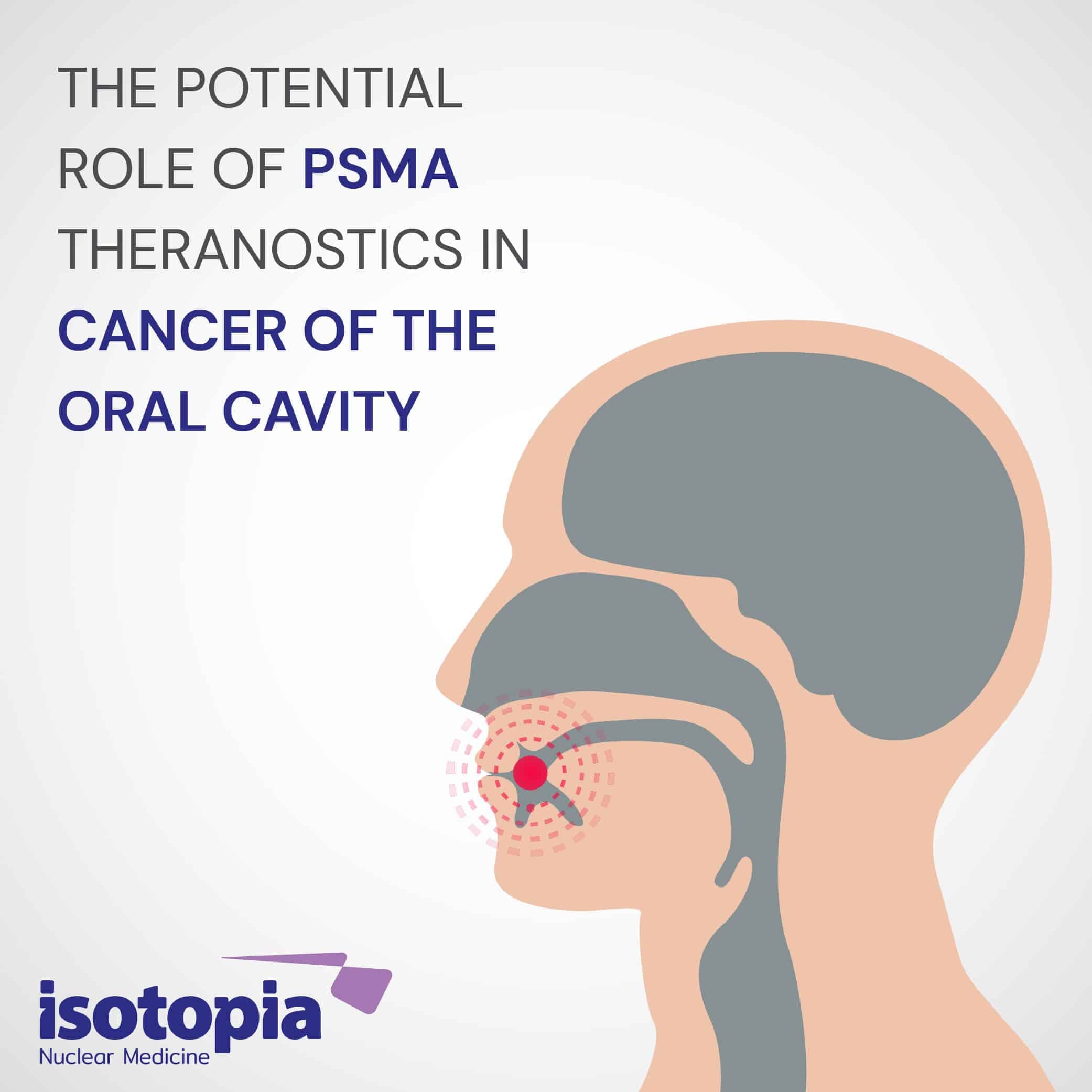 THE POTENTIAL ROLE OF PSMA THERANOSTICS IN CANCER OF THE ORAL CAVITY